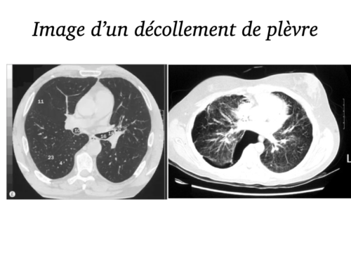 La Respiration pour tous.020
